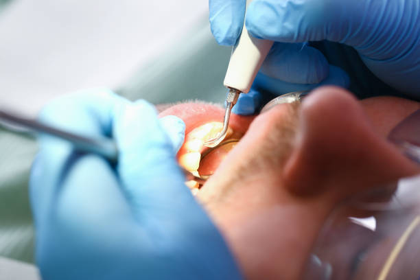 Best Tooth Infection Emergency Dentist  in Glassmanor, MD