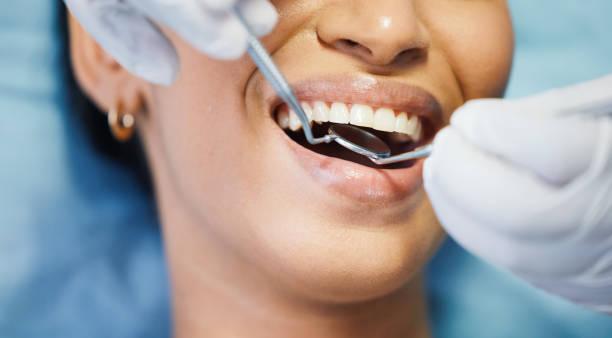 Best Dentist for Dental Trauma  in Glassmanor, MD