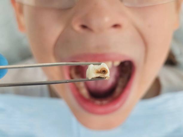 Best Tooth Pain Emergency Relief  in Glassmanor, MD