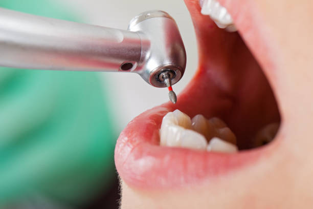Best Dentist Open Late Near Me  in Glassmanor, MD